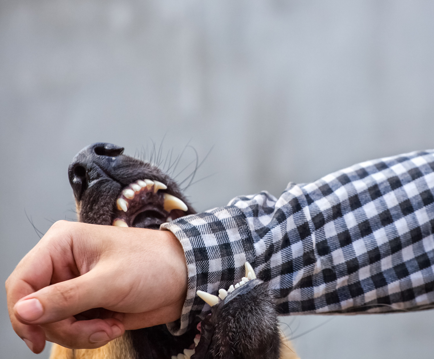 German shepherd bites a man
