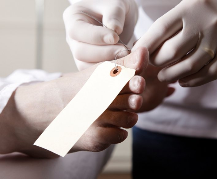 Toe Tag
