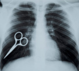 xray of chest