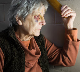 Elderly woman with black eye